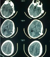 Arch Neurosci